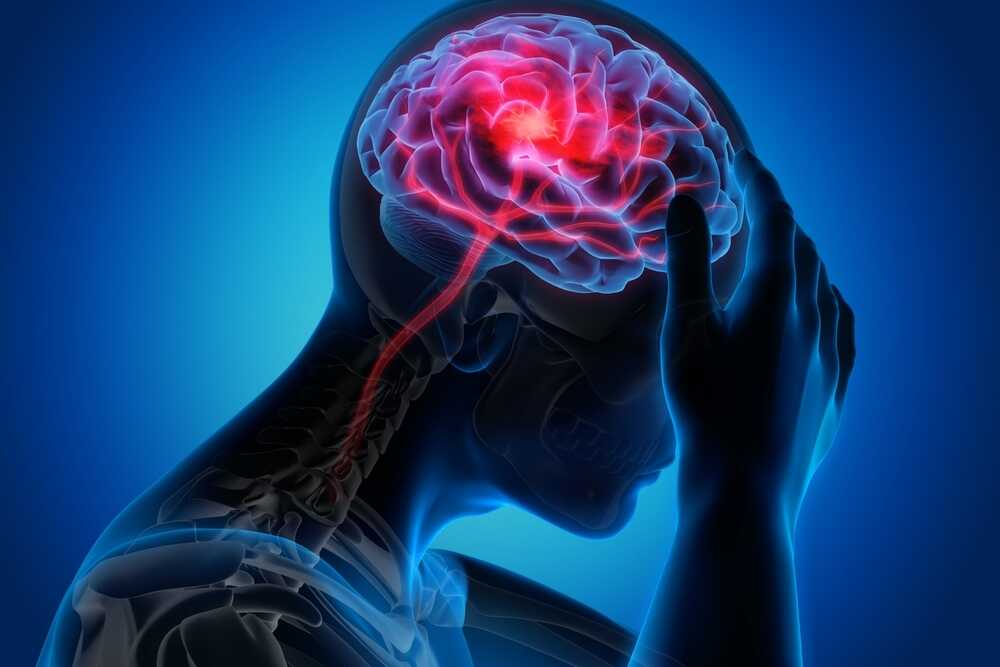 stroke mbe optimized.hu